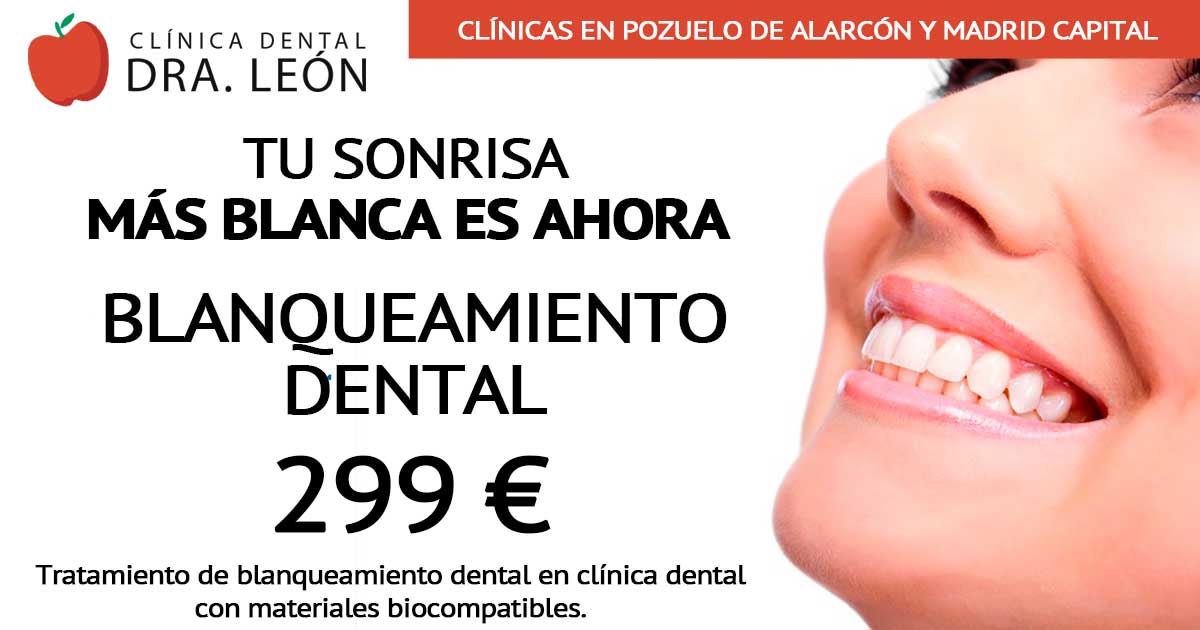 oferta blanqueamiento dental Pozuelo de Alarcón