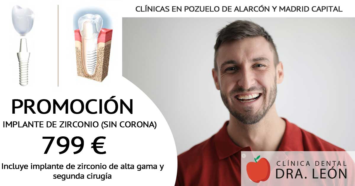 promoción implantes dentales zirconio Madrid