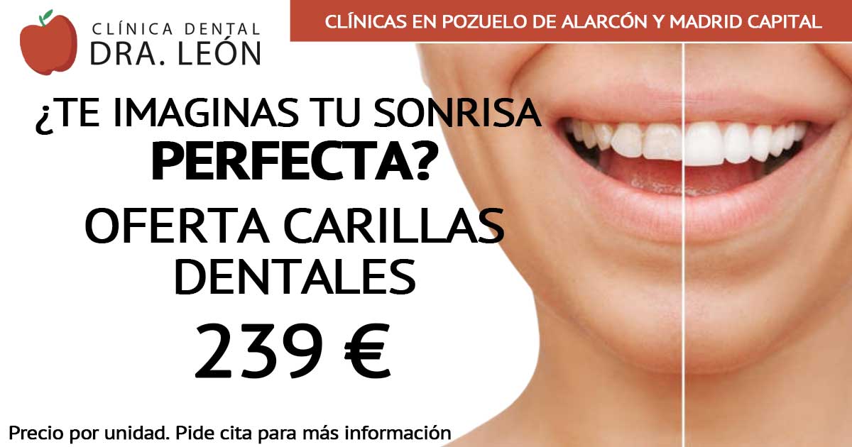 oferta carillas dentales en Pozuelo de Alarcón